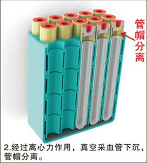 脫帽離心機(jī)的脫帽原理