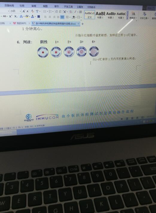 離心機(jī)好不好，現(xiàn)場(chǎng)實(shí)驗(yàn)見(jiàn)分曉